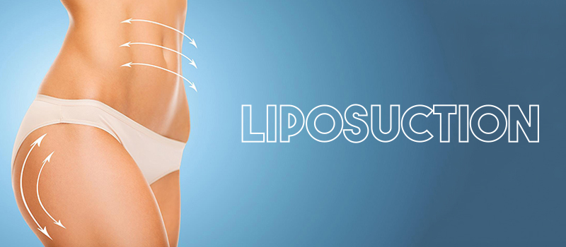 Achieving Body Contouring Excellence: The Art of Liposuction Surgery in Ludhiana