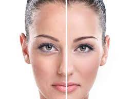 Cosmetic Procedures to Retain Your Youthful Appearance