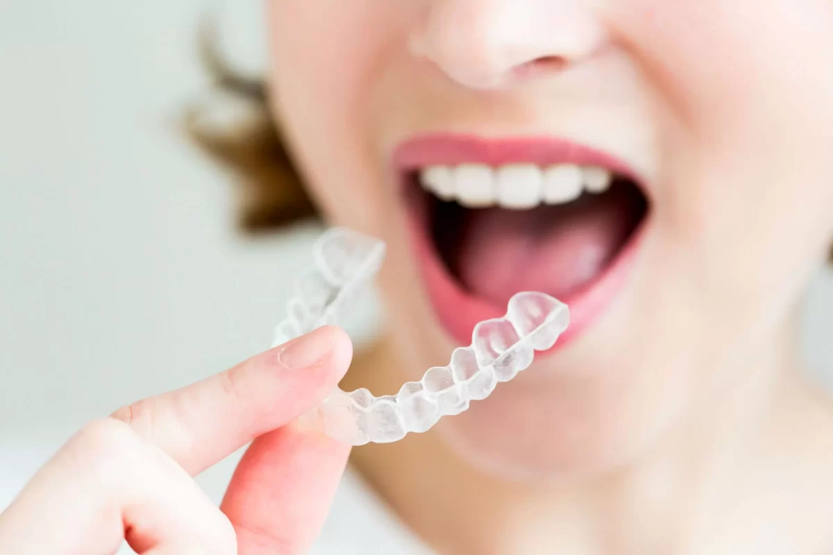 Invisalign treatment manchester