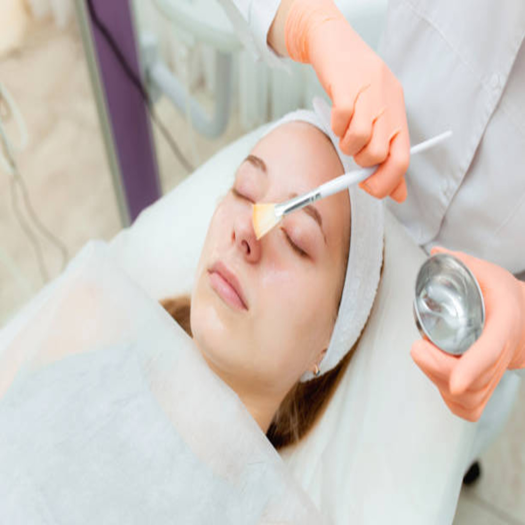 Chemical Peels in Abu Dhabi: A Fresh Start for Your Skin