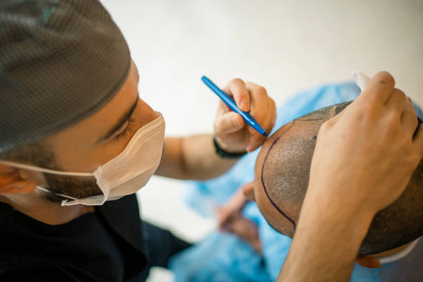 Dubai’s Celebrity Secrets: The Role of Hair Transplantation in the Glamorous Lifestyle