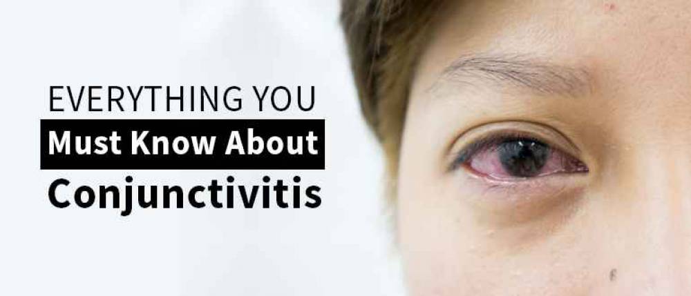 Conjunctivitis