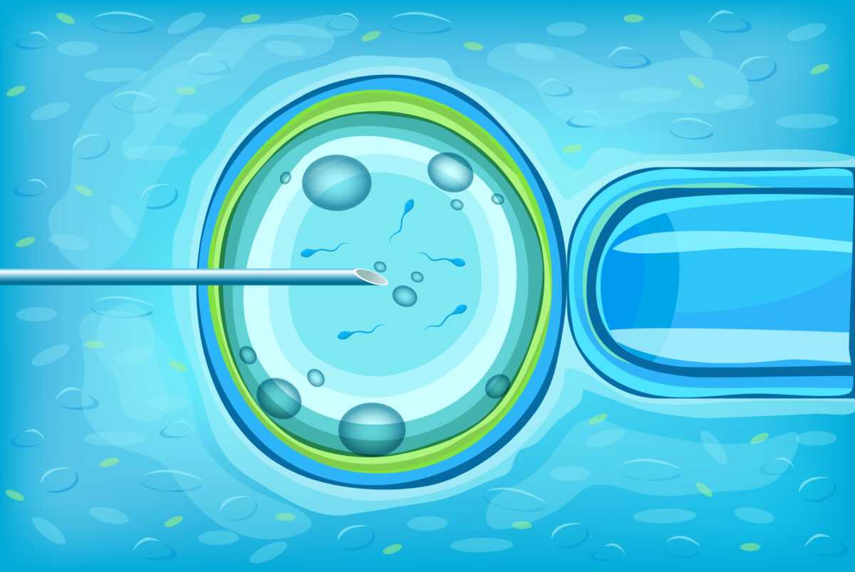 In Vitro Fertilization