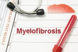 Secondary Myelofibrosis Therapeutics Market