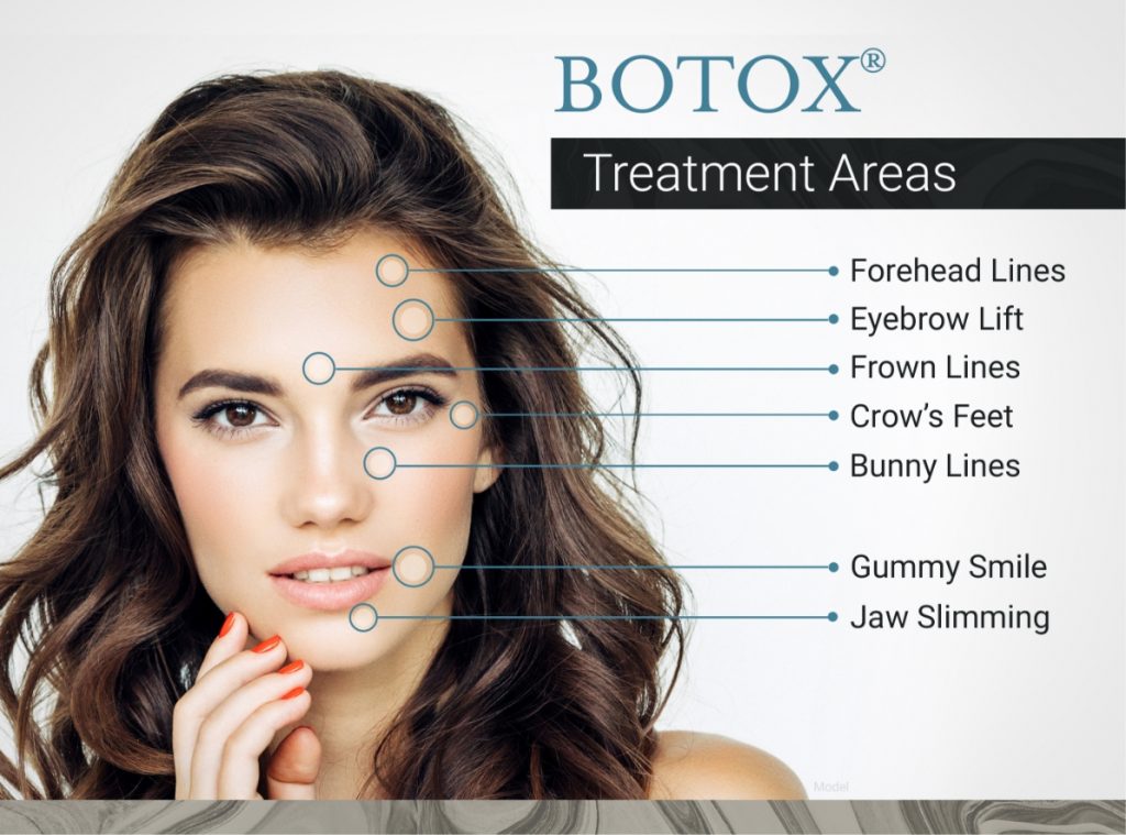 (Botox) Botulinum Toxin Type A Injections: What Is Their Science and Art?