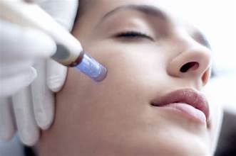 What Is Micro Needling – Know Its Process, Benefits & Cost