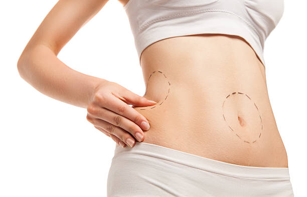 Enhance Your Shape: Liposuction Procedures in Riyadh