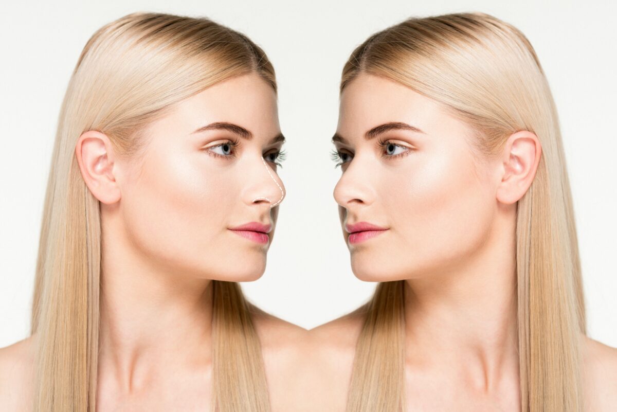 Unlock Confidence: Riyadh’s Finest Rhinoplasty Centers Revealed