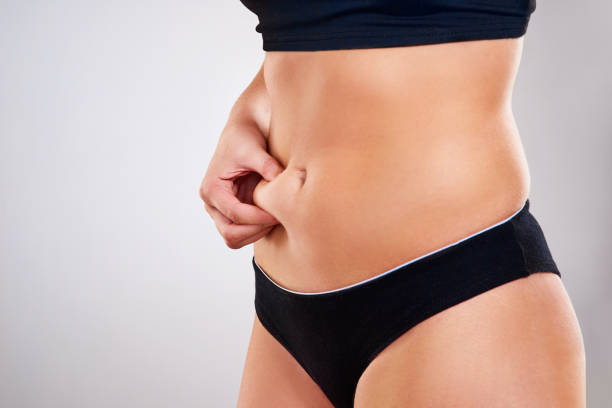 Liposuction in Islamabad: A Guide to Achieving Your Ideal Body