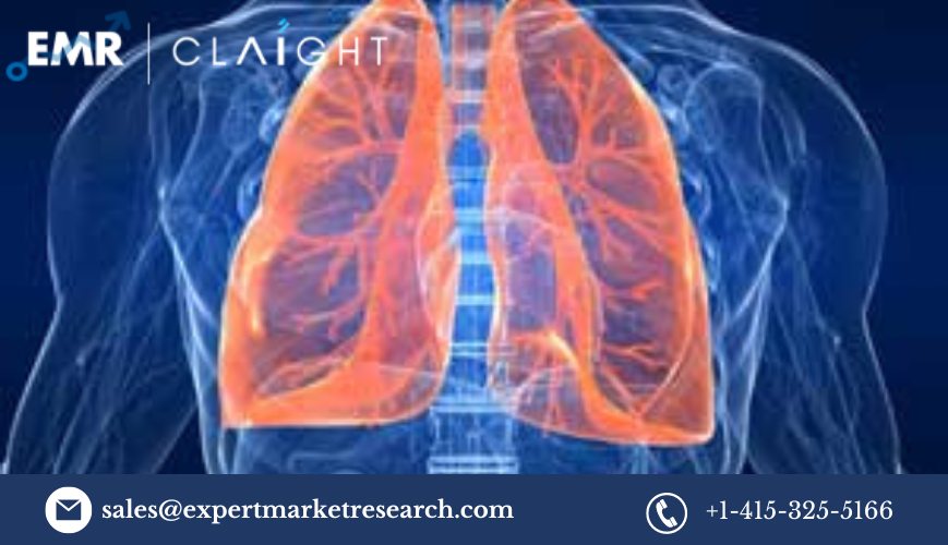 Acute Lung Injury Treatment Market Size, Trends, Growth | 2032