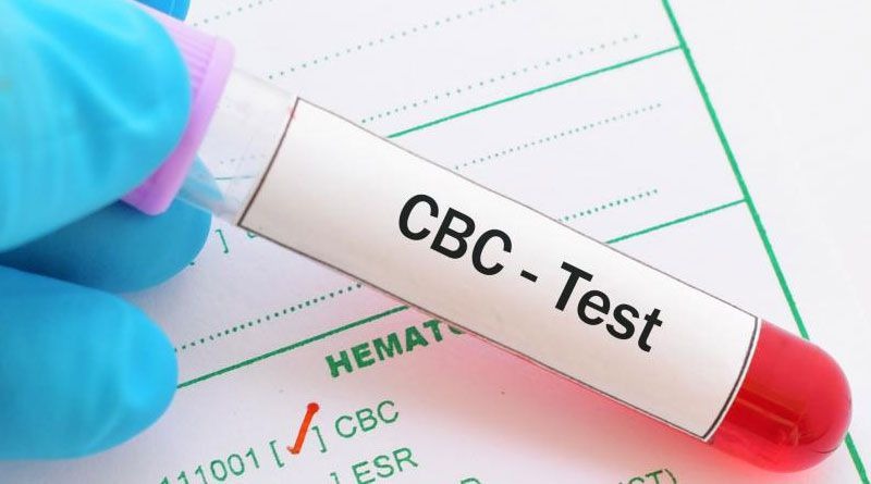 The Importance of CBC Tests in Delhi for Health Monitoring