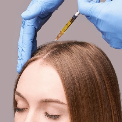 Tips for Saving on PRP Hair Treatment Costs in Dubai