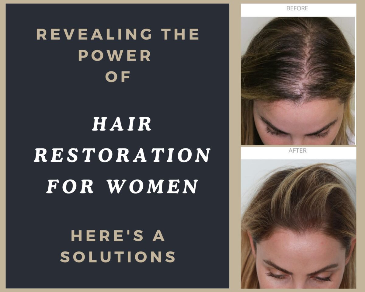 Revealing the Power of Hair Restoration for Women: Here’s a Solutions