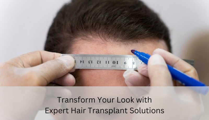 hair transplant solutions