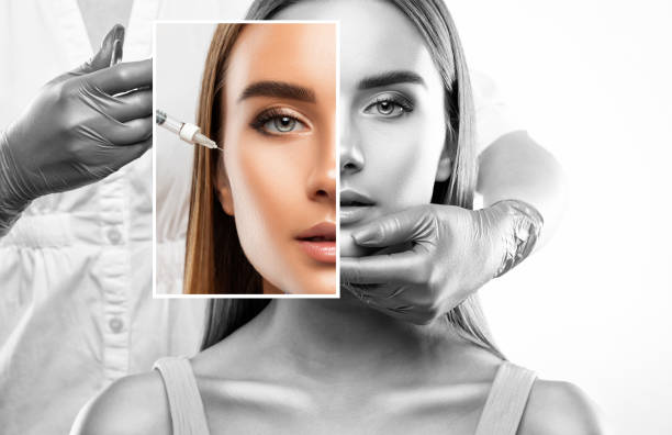 “Enhance Your Beauty: Comprehensive Guide to Botox Injections in Dubai”