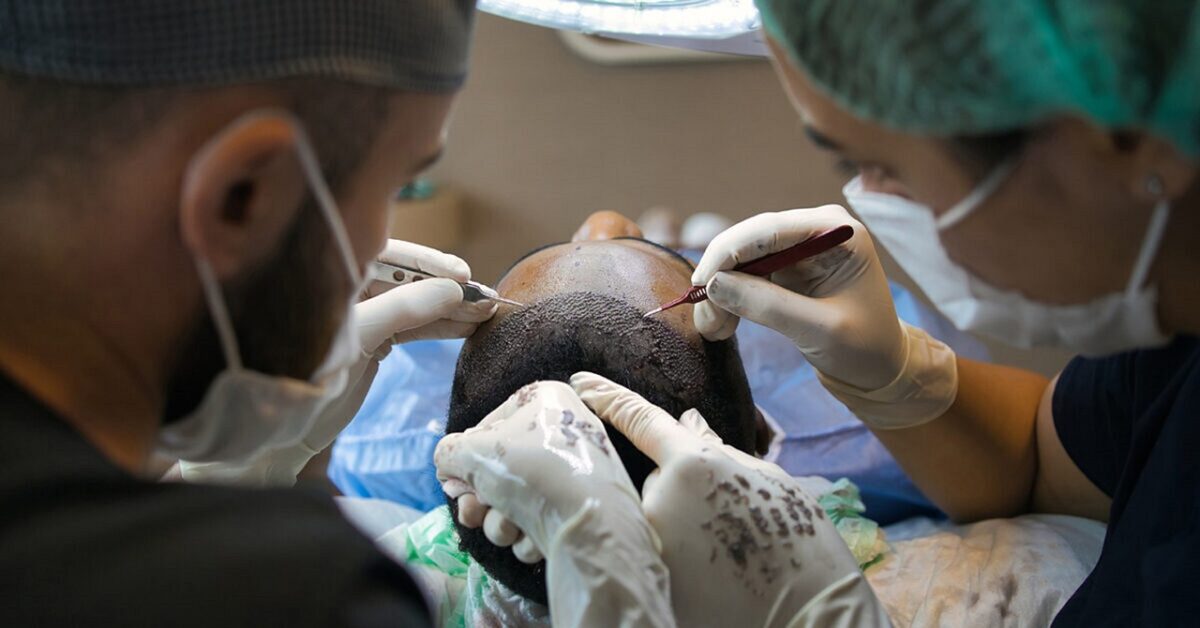 Exploring Hair Transplant in Turkey: Quality, Affordability, and Everything In Between