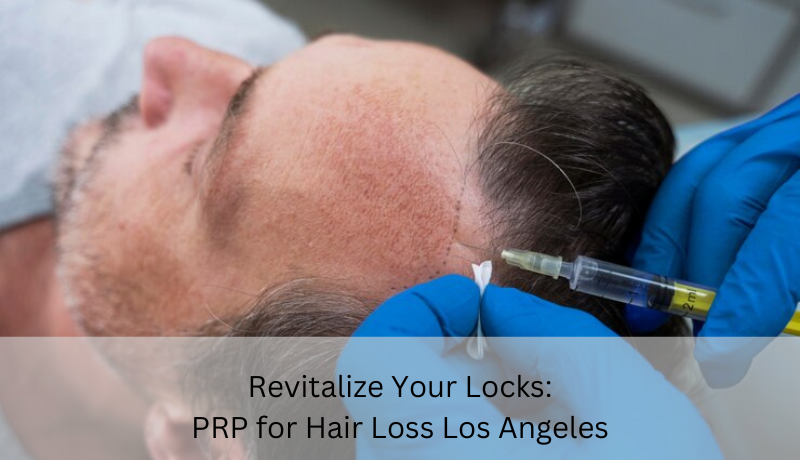 prp for hair loss Los Angeles