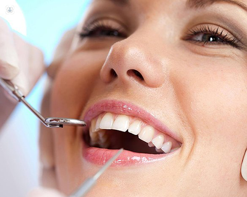 Permanent Dentures in Tampa: A Complete Guide to Enhanced Dental Restoration
