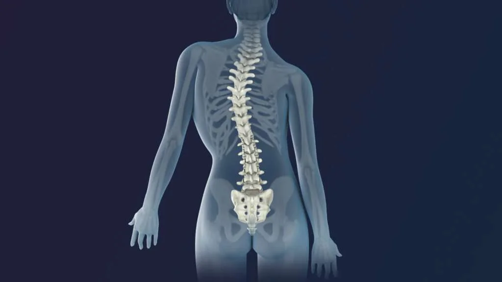 scoliosis therapy in india