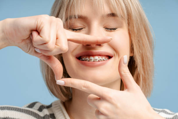 Riyadh Orthodontics: The Key to a Confident Smile