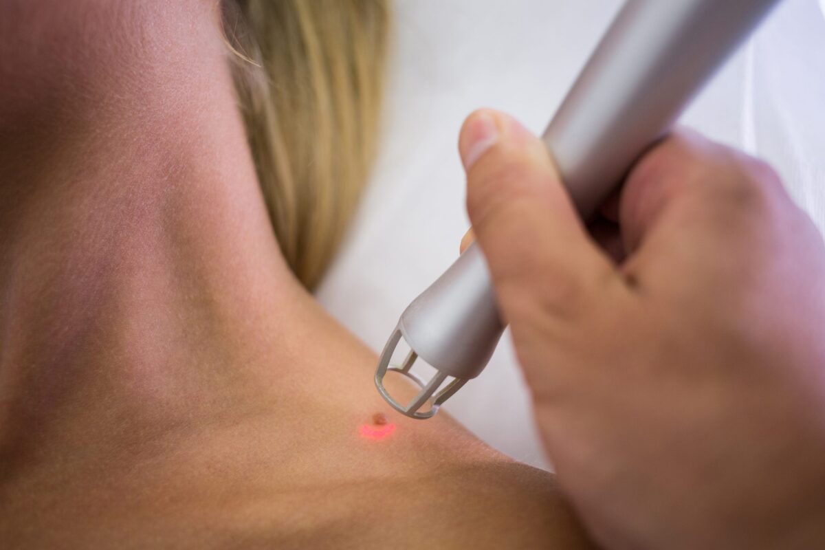 Comprehensive Care at Bulk Bill Skin Cancer Clinics Near Me