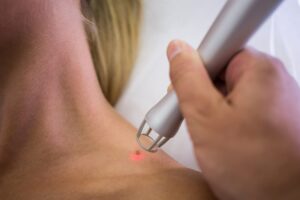 bulk bill skin cancer clinics near me