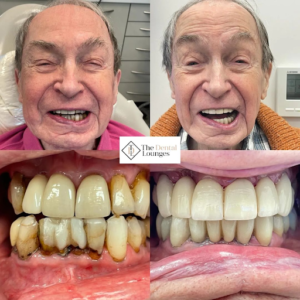 Cosmetic Dentistry Wimbledon