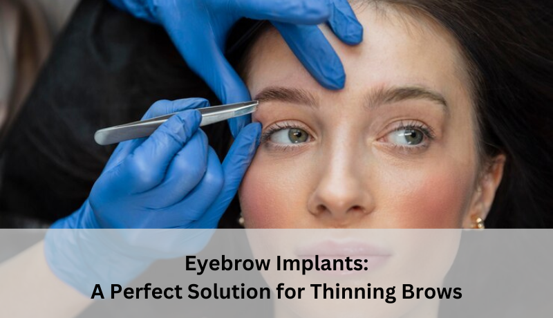 Eyebrow Implants: A Perfect Solution for Thinning Brows