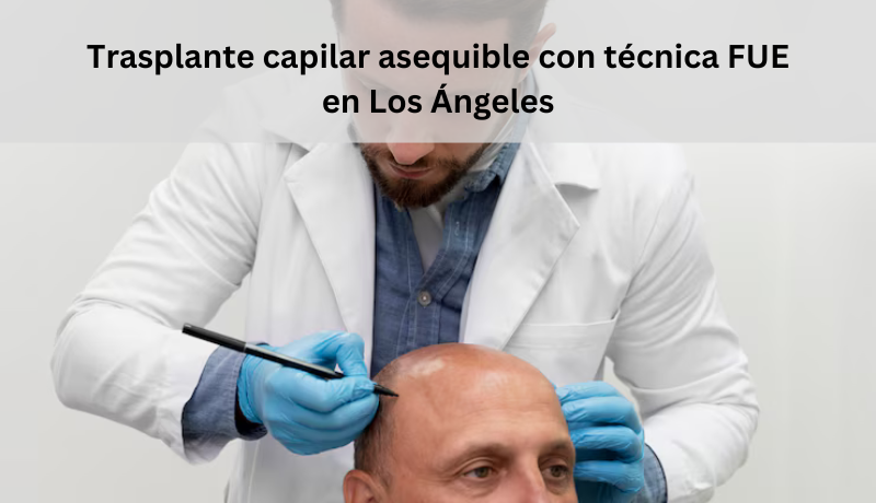 Trasplante capilar asequible con técnica FUE en Los Angeles