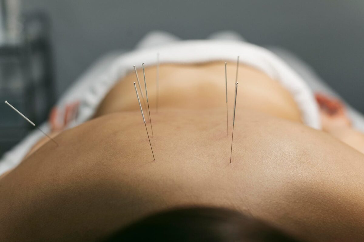 Acupuncture with biomagnetism