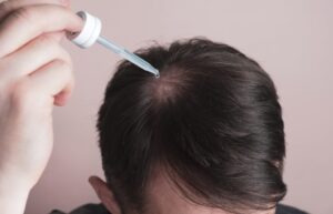 men’s hair regrowth