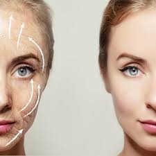 Botox for Wrinkle Prevention: When Should You Start in Dubai?