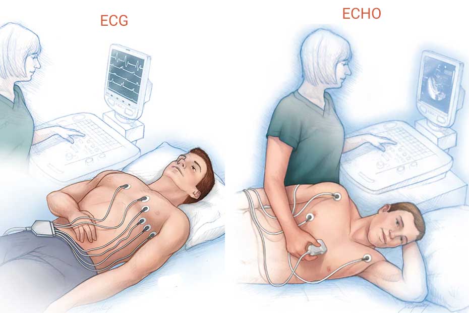 What Is the Difference Between an ECG and an Echocardiogram?