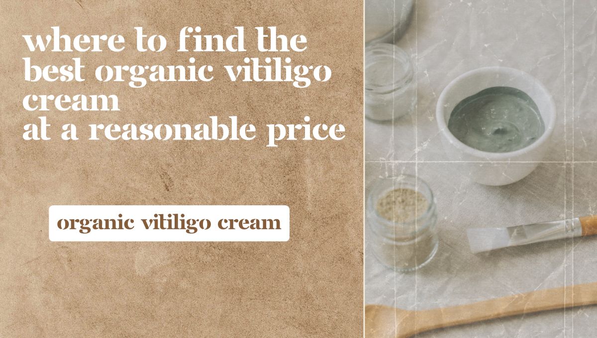 vitiligo organics price