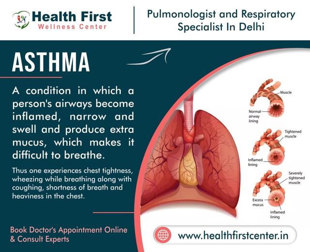 Best Asthma Doctor in Delhi: Personalized Treatment Plans by Dr. Sanchayan Roy