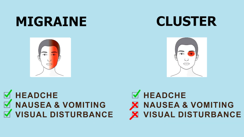 cluster headache