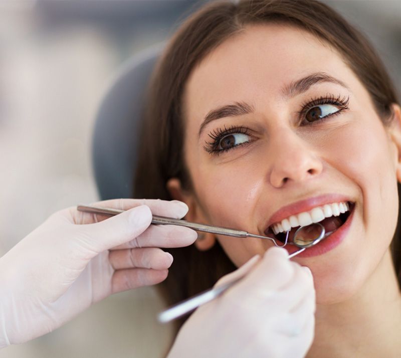 composite fillings in Edmonton