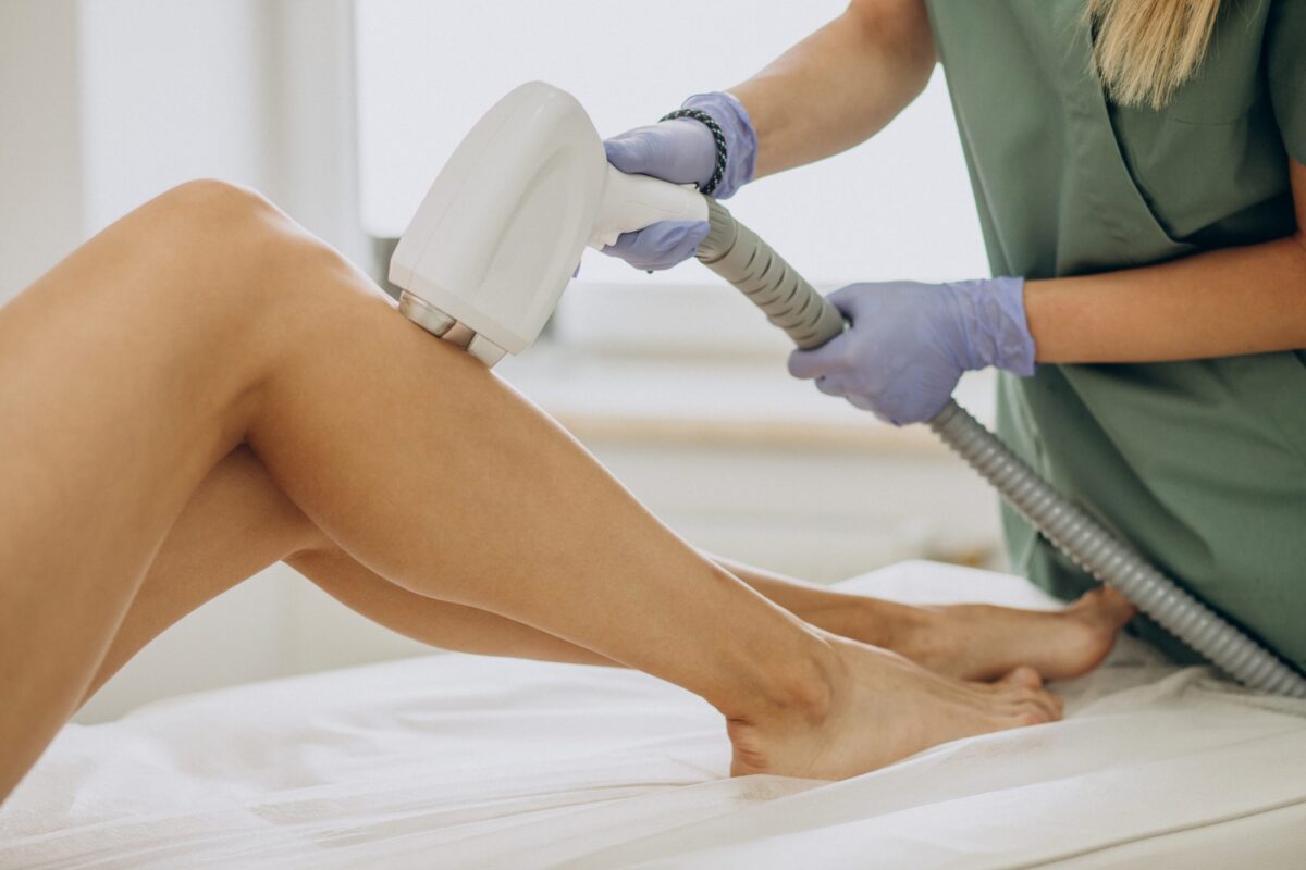 Laser Hair Removal for PCOS: Will It Work?