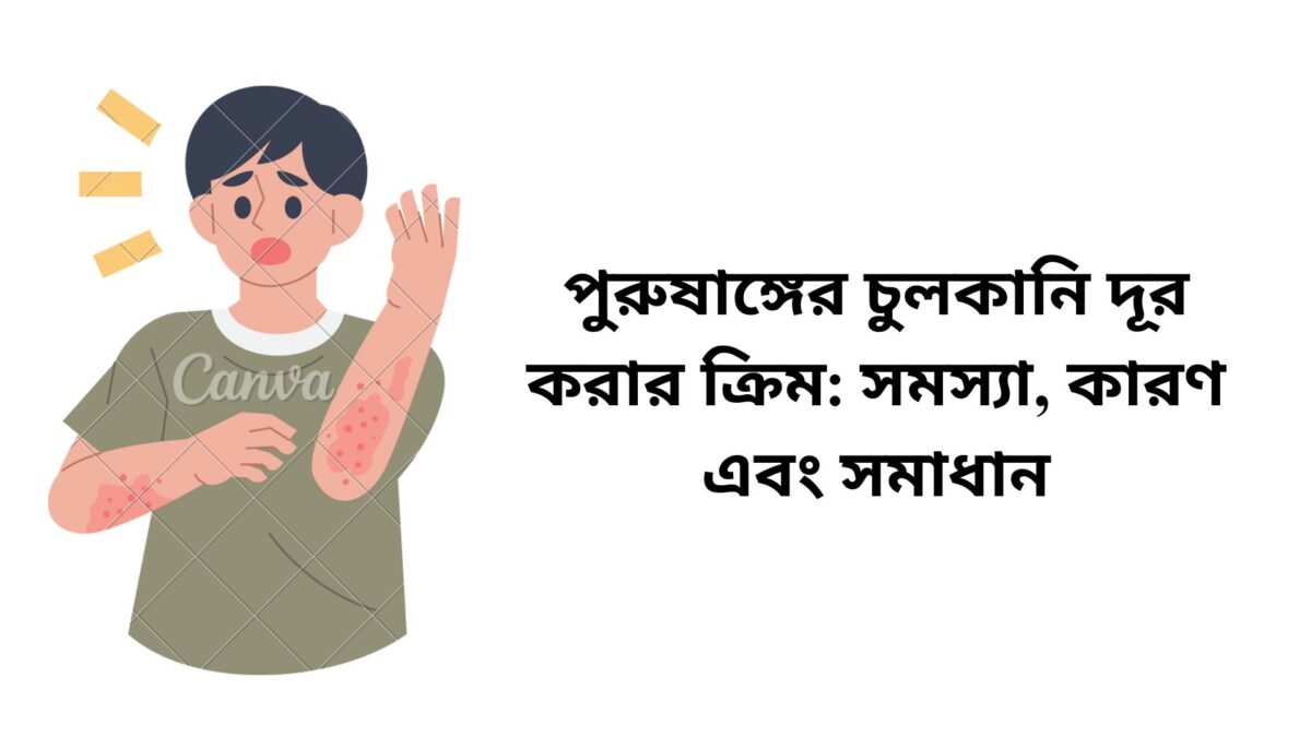 পুরুষাঙ্গের চুলকানি দূর করার ক্রিম সমস্যা, কারণ এবং সমাধান