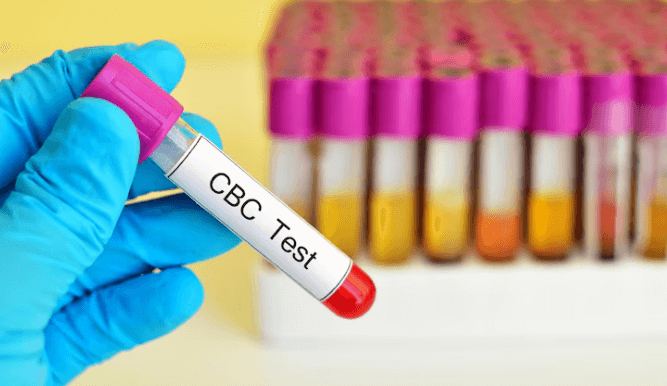 CBC Test: How to Prepare for Your Blood Draw