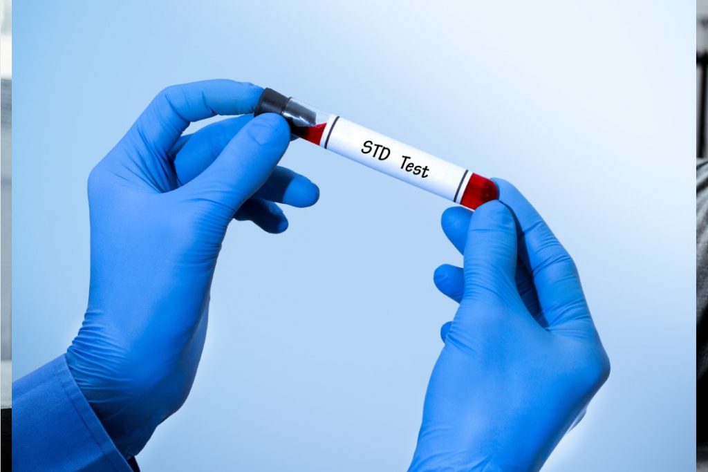 STD Testing in Dubai: Your Guide to Safe and Confidential Care