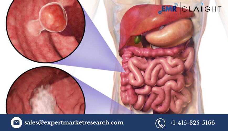 North America In-Vitro Colorectal Cancer Screening Tests Market