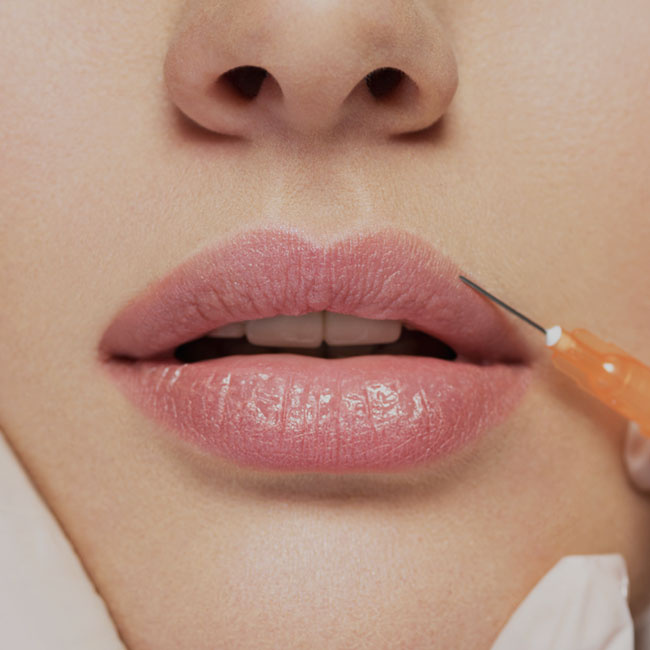 How Does Lip Augmentation Affect Your Daily Life?