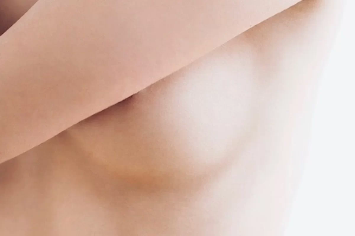 Recovery and Aftercare Tips Post Nipple Correction Surgery