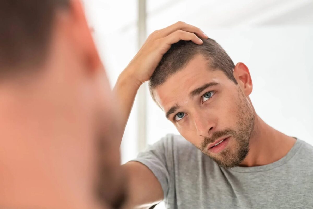 What Is the Best Age to Consider a Hair Transplant?