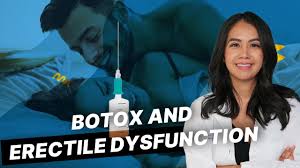 Botox for Erectile Dysfunction