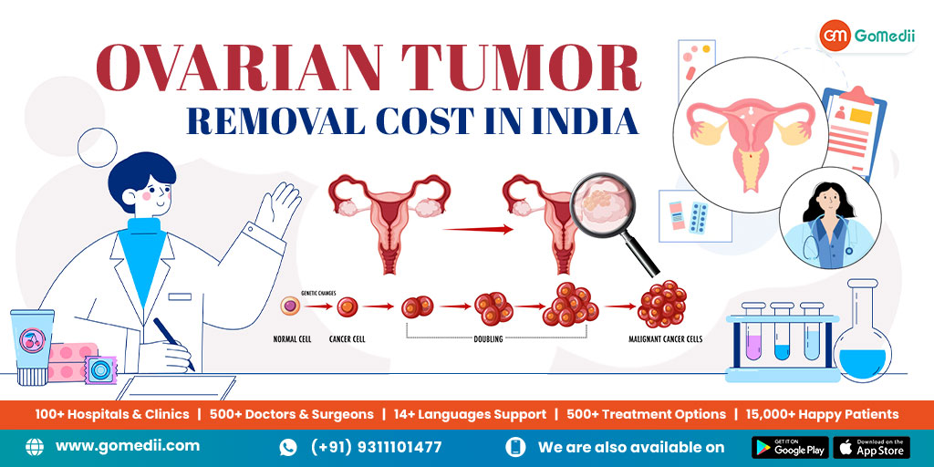 Ovarian Tumor Treatment