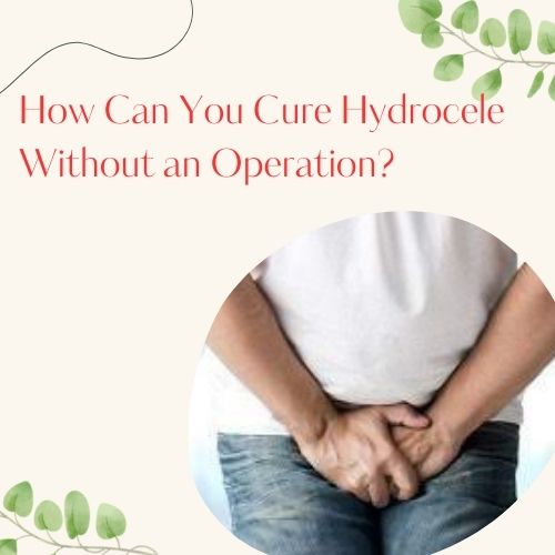 How Can You Cure Hydrocele Without an Operation