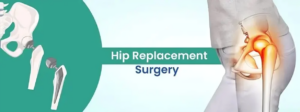 https://www.mejocare.com/hip-replacement-surgery-cost-india